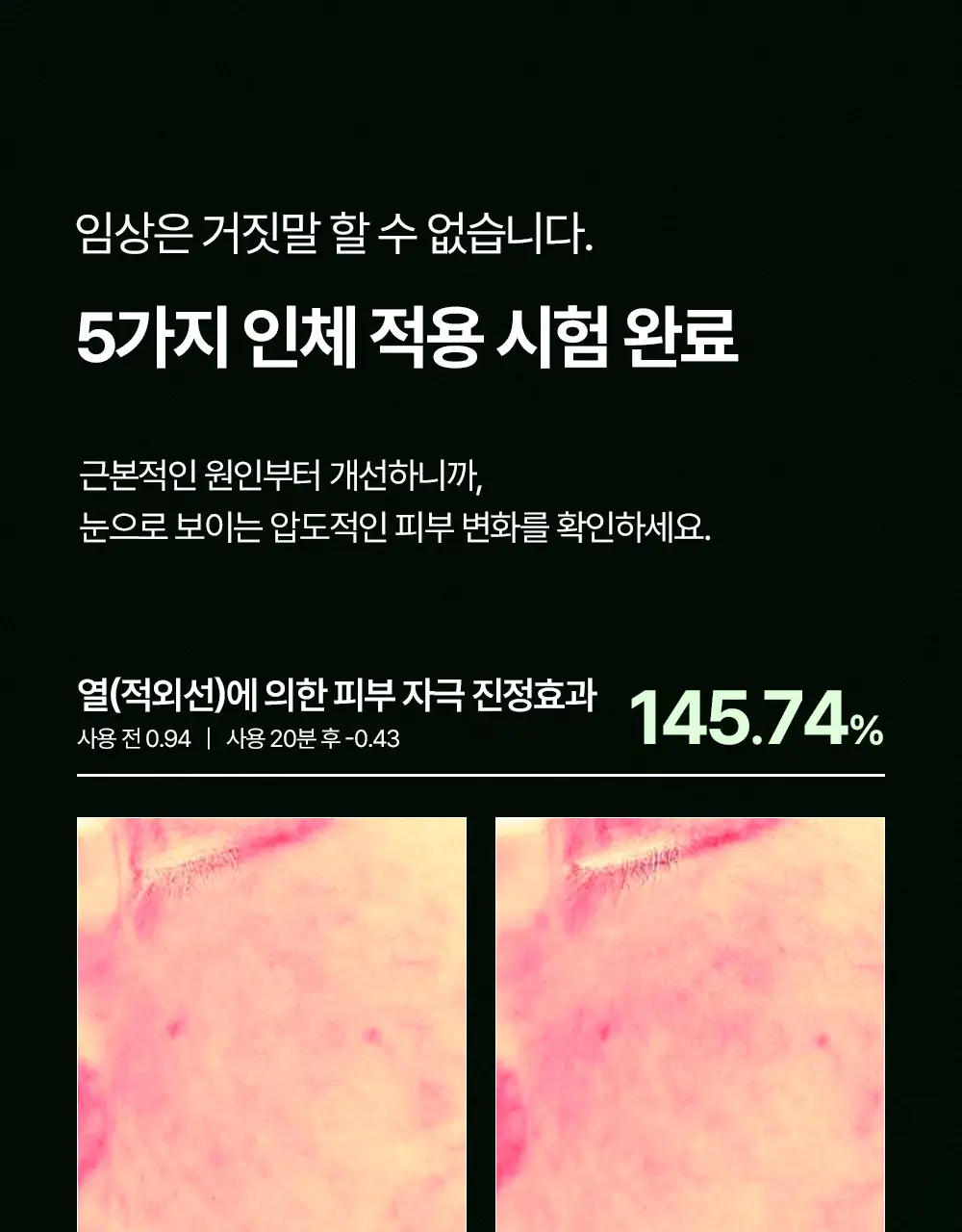 [티벳동생 공동개발] 오아조 더마 테카 카밍 크림 50ml 상세페이지 9